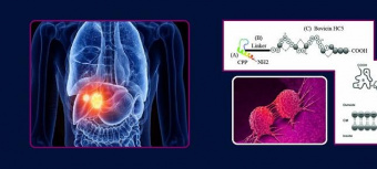 توصل باحثو جامعة طهران إلى طريقة جديدة لعلاج سرطان الكبد