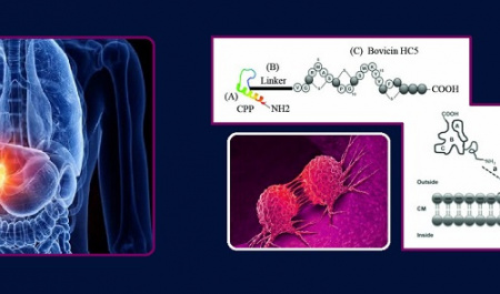 It took place for the first time in Iran: University of Tehran researchers have achieved a new method of treating liver cancer 