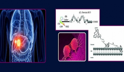 University of Tehran researchers have achieved a new method of treating liver cancer