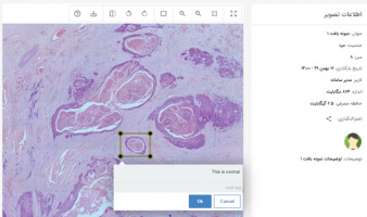 UT and Sharif University of Technology Design and Implement Slide Scanner and Telepathology System