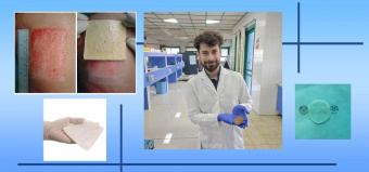 It was done by the researchers of University of Tehran and University of Pisa in Italy:  Making biodegradable wound dressings with fast absorption capability