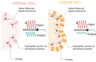 Designing a new diagnostic system for the most common cancer among Iranian women by scanning with a high-frequency electromagnetic wave probe.