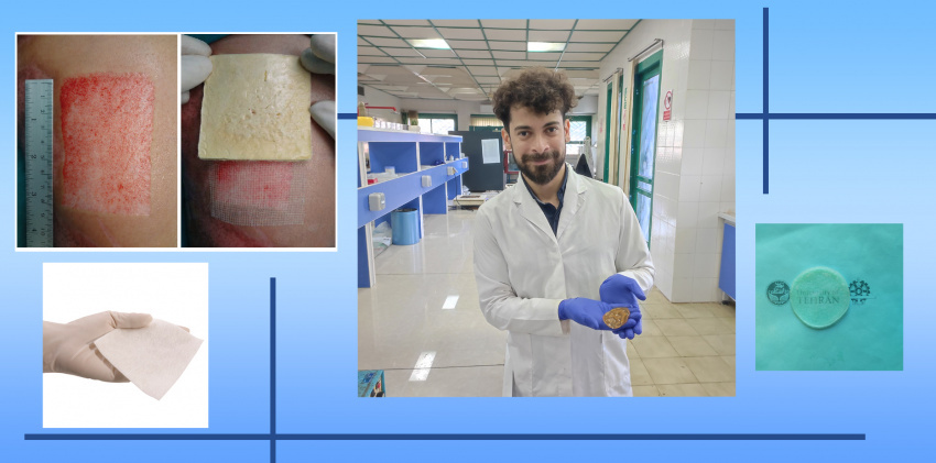 It was done by the researchers of University of Tehran and University of Pisa in Italy:  Making biodegradable wound dressings with fast absorption capability