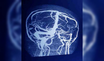 راه‌ حل جدید پژوهشگران دانشگاه تهران برای افزایش امنیت هوش مصنوعی در تحلیل MRI مغز